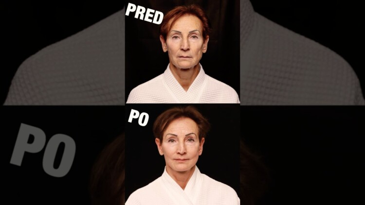 Preload Image